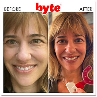 byte before after jenny